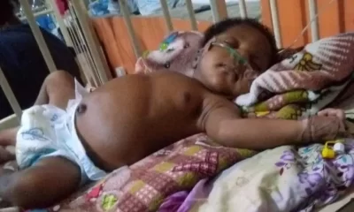 Man Cries Out For Help For Son's Heart Surgery