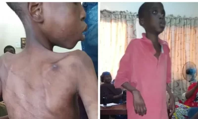 13-Year-Old Boy Escapes After Being Tortured By Mother, Landlord