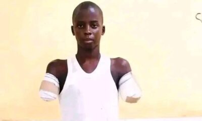 Gombe NBA Condemns Child Amputation Over Alleged Phone Theft